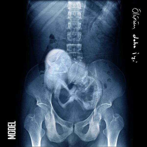 Model - Ölürüm Daha İyi (Single)